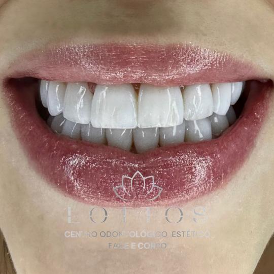 Foto 2 de Clínica Lottos - Centro Odontológico e Estético Face e Corpo