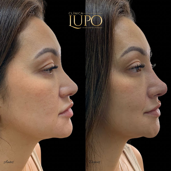 Foto 3 de Clínica LUPO Estética Avançada, Botox, Harmonização Facial, Preenchimento, Laser CO2, Colágeno na Lapa e Barra Funda