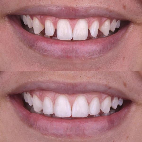 Foto 2 de Clinica Lux Spa Odontológico e Saúde Integrativa