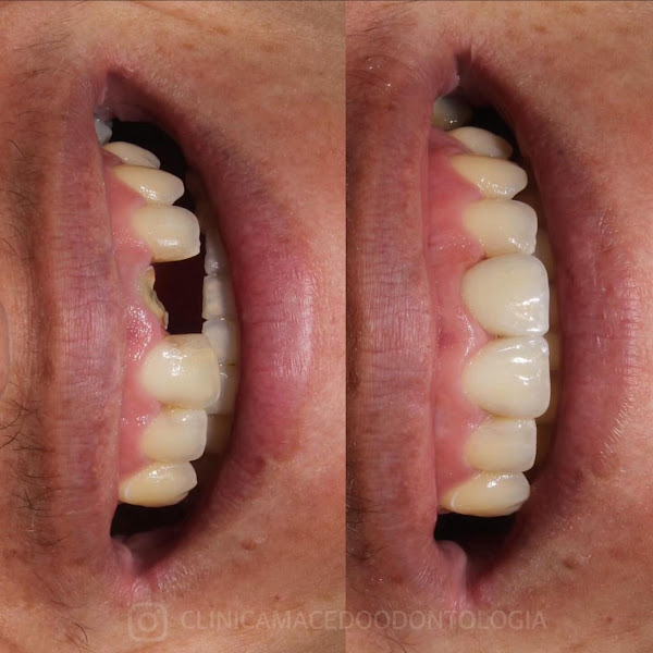 Foto 3 de Clínica Macêdo odontologia Belém