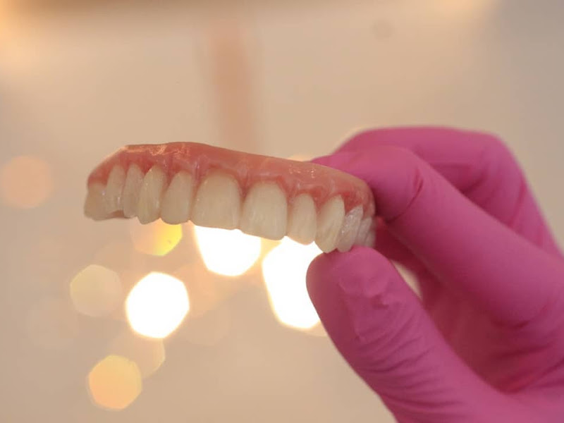 Foto 4 de Clínica Magna | Implante Dentário | Prótese Protocolo | Invisalign | Alinhadores | Clínica Odontológica Poços de Caldas