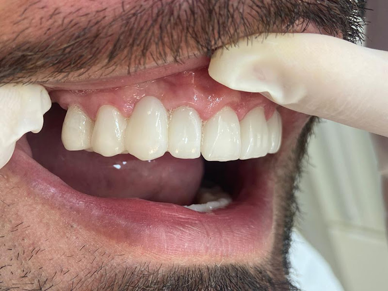 Foto 5 de Clínica Magna | Implante Dentário | Prótese Protocolo | Invisalign | Alinhadores | Clínica Odontológica Poços de Caldas