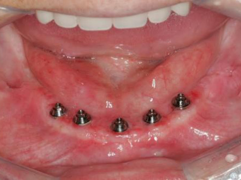 Foto 6 de Clínica Mais Saúde (Odontologia) In Saúde Laboratório