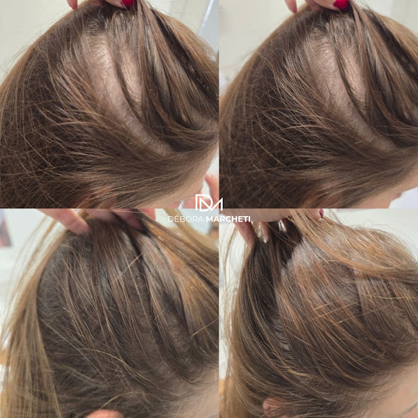 Foto 2 de Clínica Marcheti | Estética Avançada | Especialista em Harmonização Facial | São Caetano do Sul