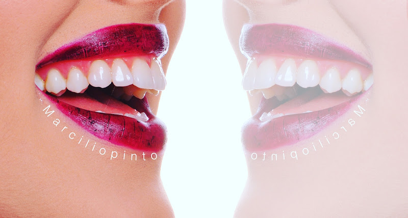 Foto 3 de Clínica Marcílio Pinto - Odontologia Especializada