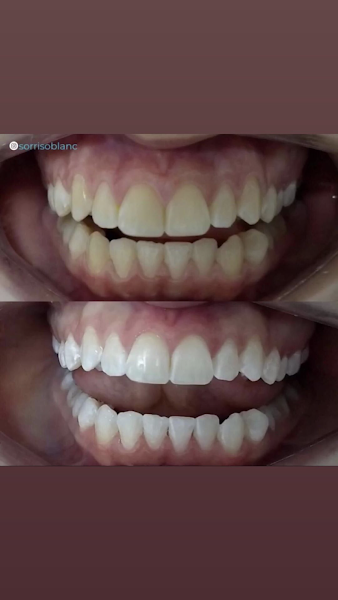 Foto 3 de Clínica Maria Clara Magalhães Harmonização Orofacial