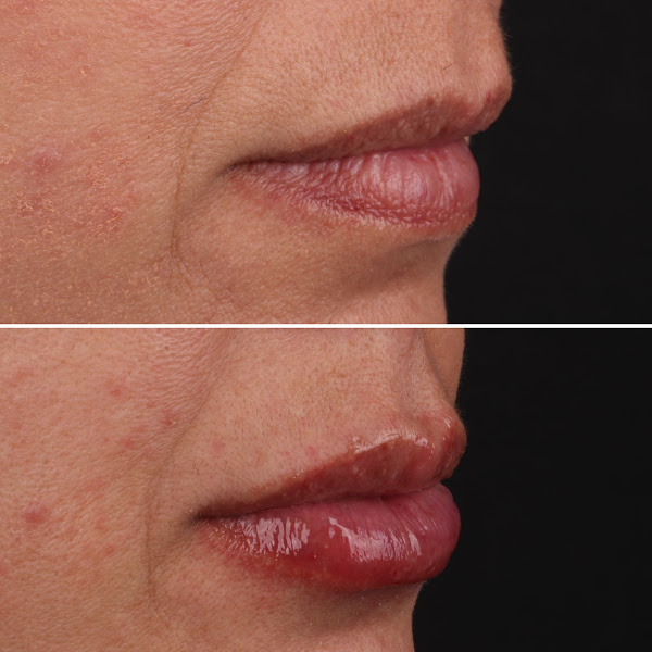 Foto 3 de Clínica Mariana Wolf - Implante e prótese