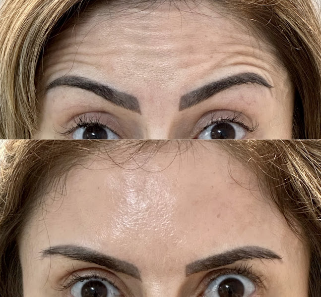 Foto 3 de Clínica Maryan - Harmonização Facial