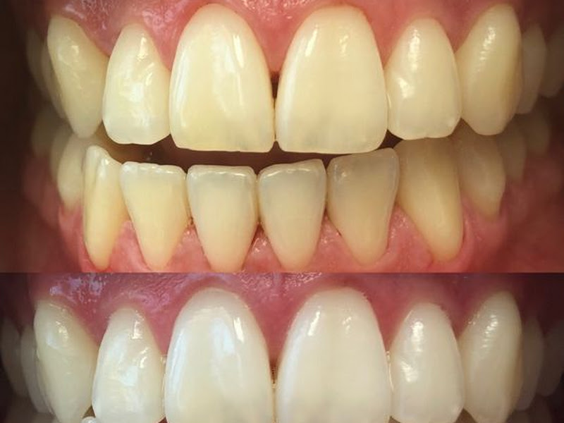 Foto 5 de Clínica Massafelli Odontologia Especialidades Mooca