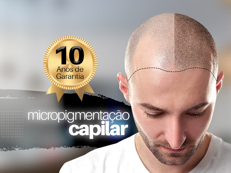 Foto 9 de Clínica Matarazzo Transplante Capilar RJ