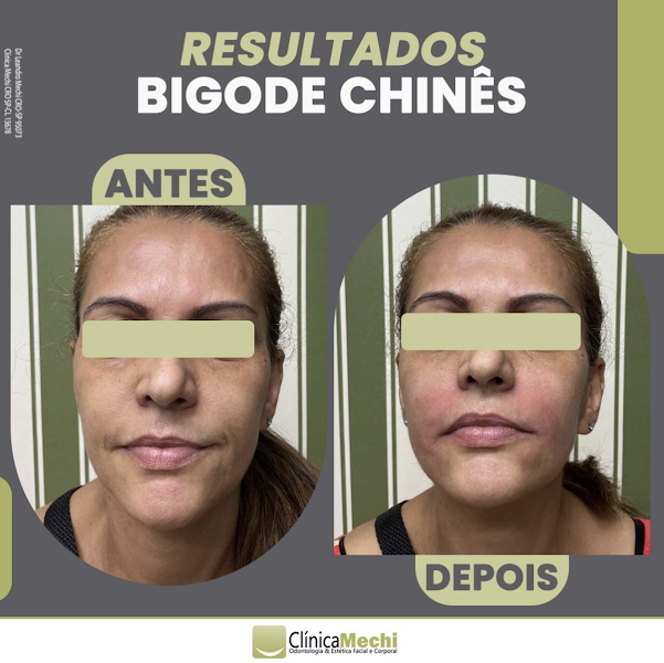 Foto 3 de Clínica Mechi