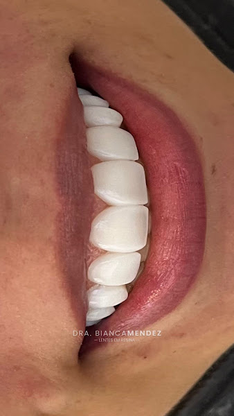 Foto 2 de Clínica Mendez Pinheiros - Odontologia Estética