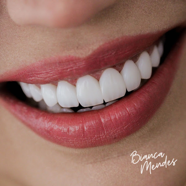 Foto 3 de Clínica Mendez Pinheiros - Odontologia Estética