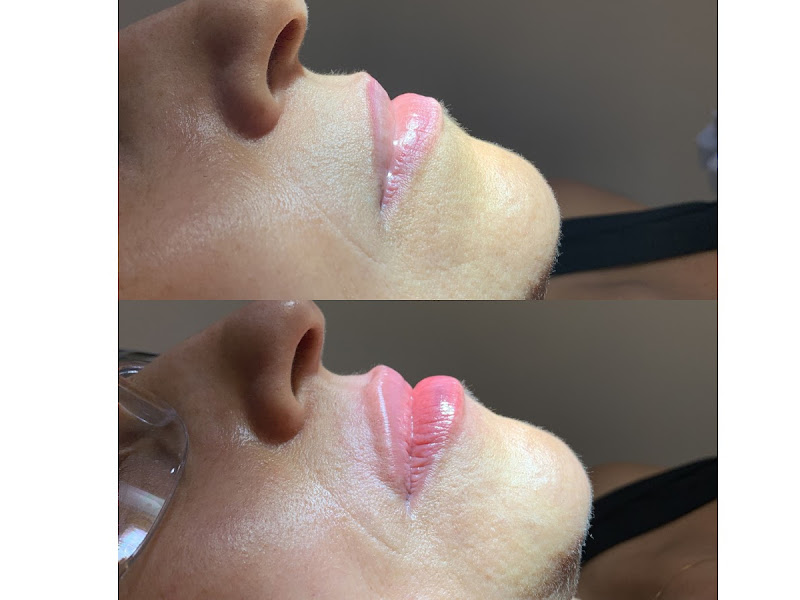 Foto 7 de Clínica Mendez Pinheiros - Odontologia Estética