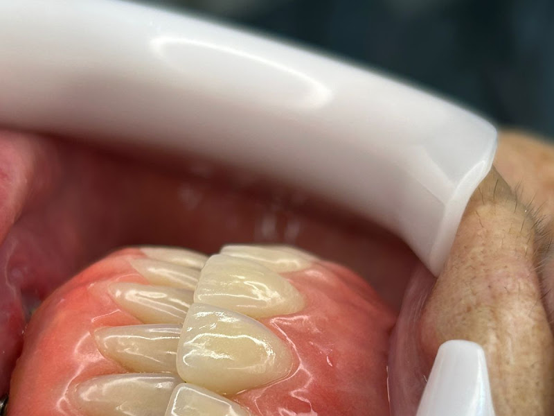 Foto 10 de Clínica Menezes Odontologia e Estética | Planaltina/DF