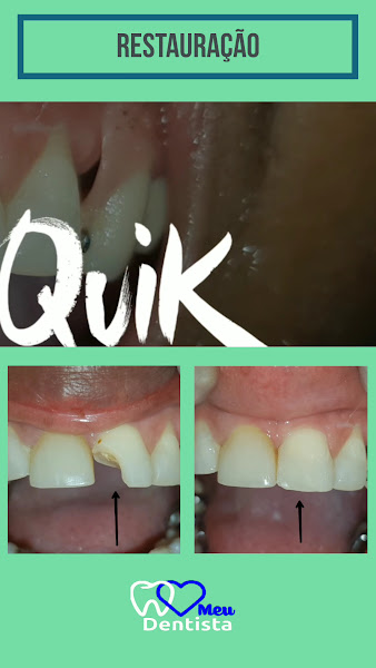 Foto 3 de Clínica Meu Dentista