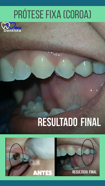 Foto 4 de Clínica Meu Dentista