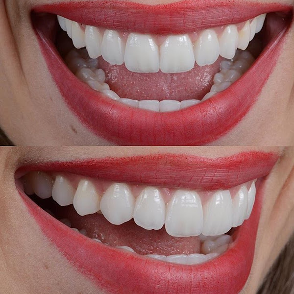 Foto 2 de CLÍNICA MILLANO Odontologia & Harmonização Orofacial- Curitiba