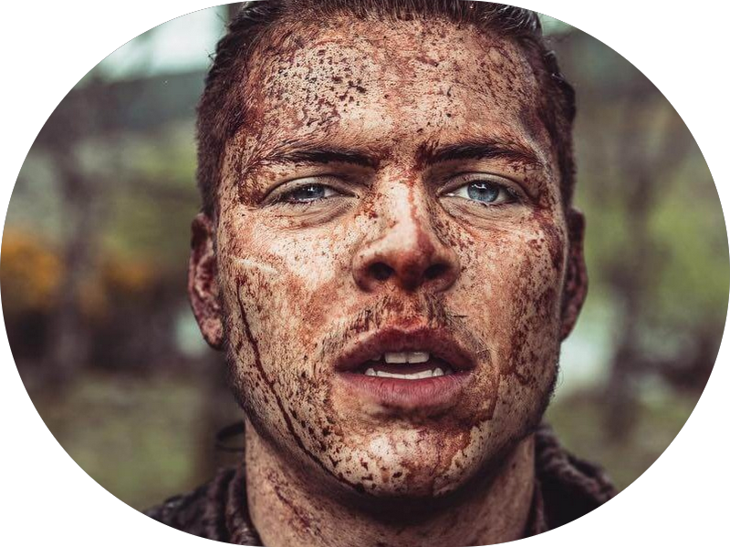 Foto 2 de Clínica Mitchell Odontologia Integrada I Dentista em Ipatinga