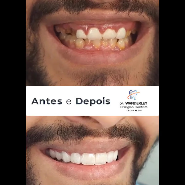 Foto 4 de Clínica Molar - Dr. Wanderley M. Moralejo - Consultório Odontológico Grajaú