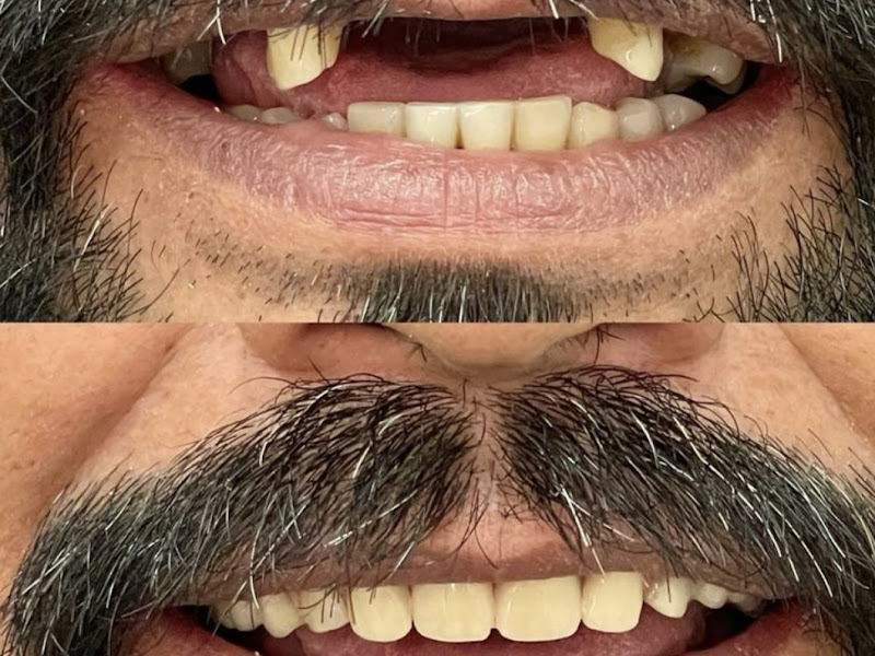 Foto 10 de Clínica Molar - Dr. Wanderley M. Moralejo - Consultório Odontológico Grajaú