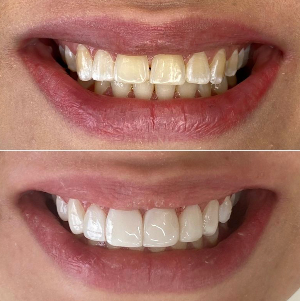 Foto 3 de Clínica Monice - Estética Individualizada