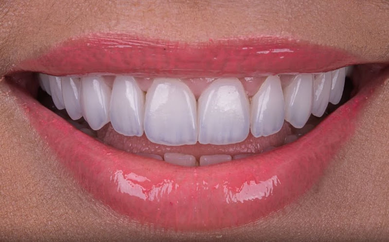 Foto 2 de Clinica MSL Odontologia - Reabilitação oral e implantes dentários