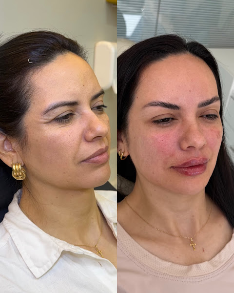 Foto 3 de Clínica Mykaelle Correia | Harmonização Facial