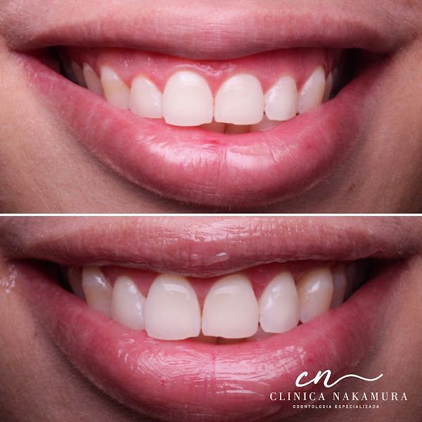 Foto 3 de Clínica Nakamura - Odontologia Especializada