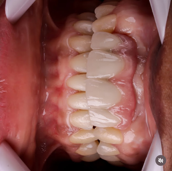 Foto 3 de Clínica Naturalize Odontologia Estética | Facetas e implantes dentários em São Carlos - SP