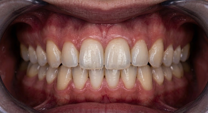Foto 3 de Clínica NC - Odontologia Estética - Alphaville
