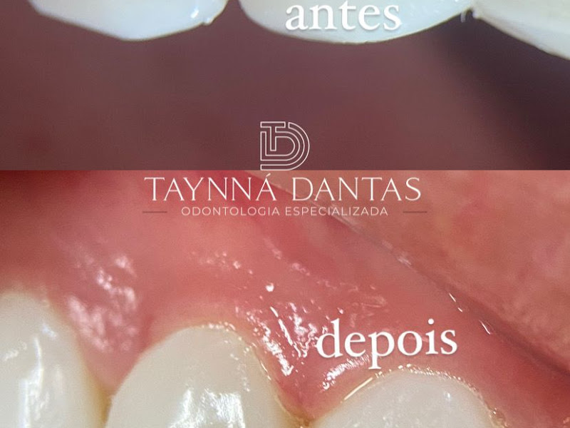 Foto 8 de CLÍNICA NEODÔNTICA PRIME- Implantes Dentários, Próteses Dentárias, Aparelhos Ortodônticos - Campina Grande