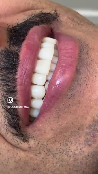 Foto 3 de CLINICA NERES ODONTO - C.N.O ODONTOLOGIA