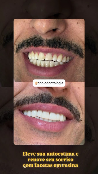 Foto 4 de CLINICA NERES ODONTO - C.N.O ODONTOLOGIA
