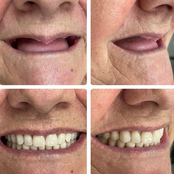 Foto 3 de Clínica Neves Odontologia