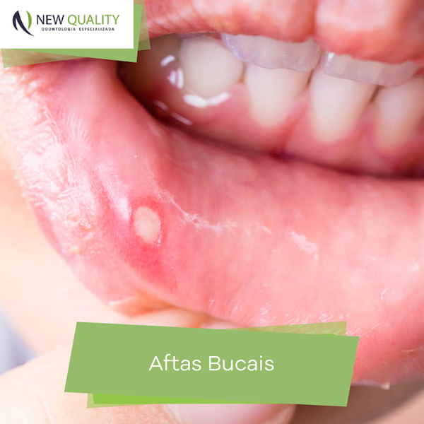 Foto 3 de Clínica New Quality | Fortaleza