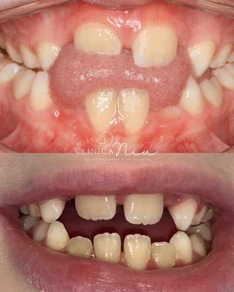 Foto 3 de Clínica Niu | Odontopediatria em São Miguel Paulista