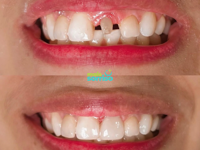 Foto 2 de Clinica Nosso Dentista