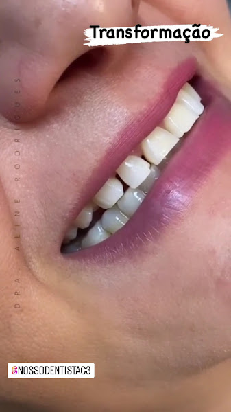 Foto 3 de Clinica Nosso Dentista Cidade Nova