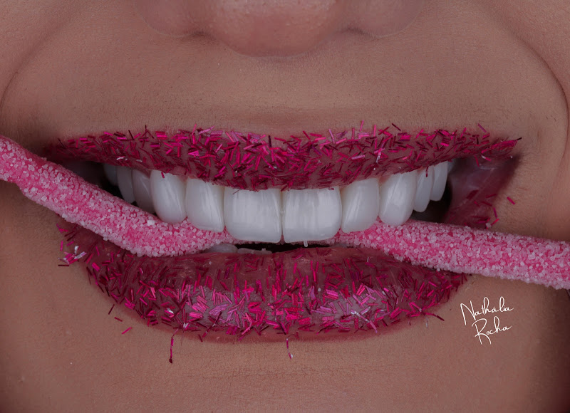 Foto 3 de Clínica NR Odontologia Estética | Lentes em Resina