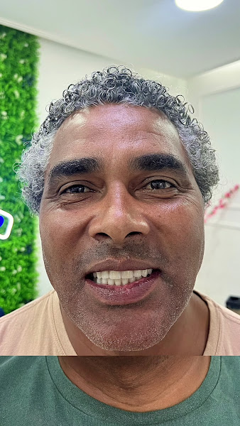 Foto 3 de Clínica Núcleo do Bem-Estar - Implantes Dentários, Lentes de contato, Harmonização facial em Santo André