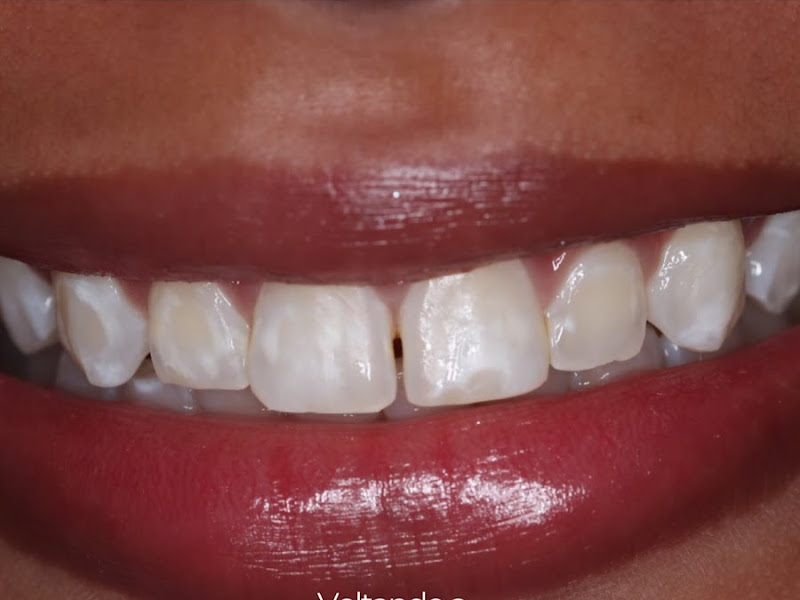 Foto 3 de CLINICA ODONTO A.M.N