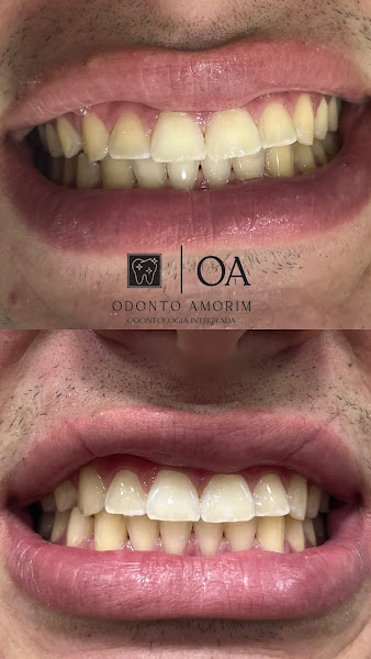Foto 3 de Clínica Odonto Amorim Odontologia Integrada