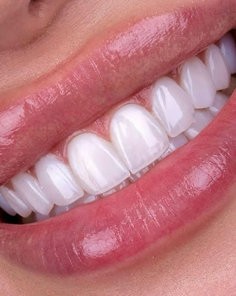 Foto 3 de Clinica Odonto Clarity | Implantes Dentário | Dentista | Bairro Cecap | Presidente Prudente - SP