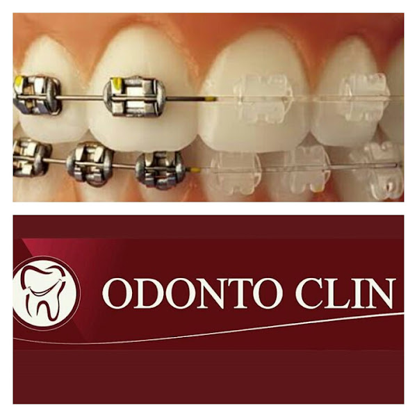 Foto 3 de Clínica Odonto Clín