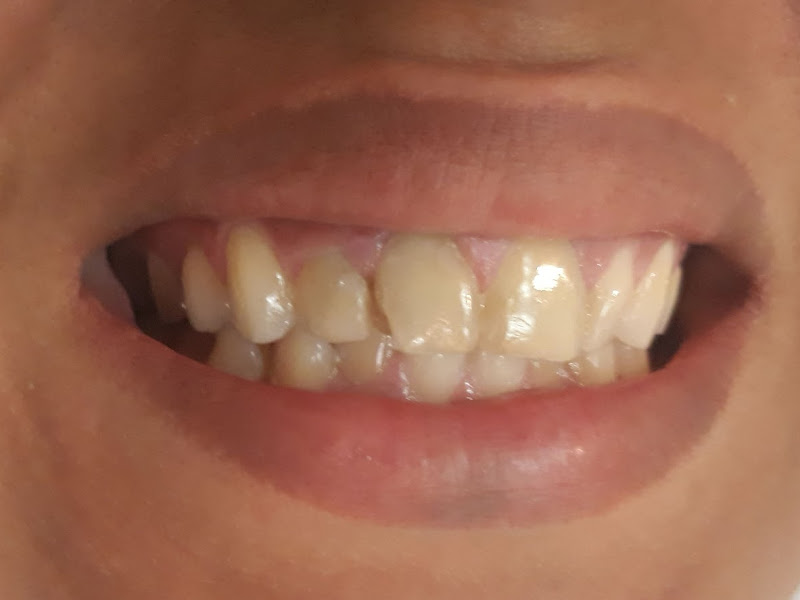 Foto de Clínica Odonto Estética - Dr. João Vitor