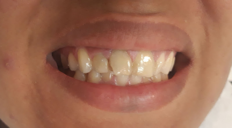 Foto 2 de Clínica Odonto Estética - Dr. João Vitor