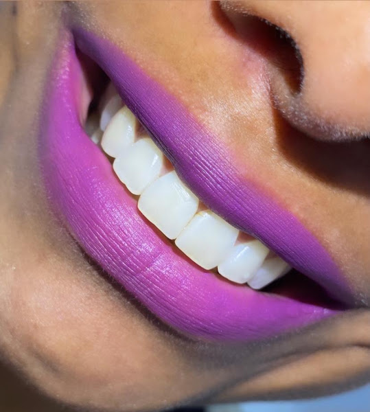 Foto 3 de Clínica Odonto Flash- Samambaia Norte