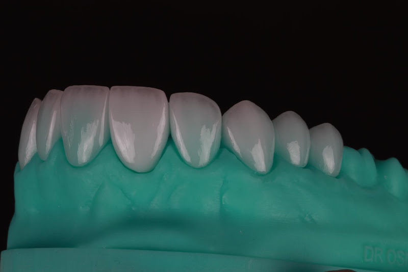 Foto 5 de Clínica Odonto Líder | Dentista | Implante | Lentes em Resina Rio Branco AC