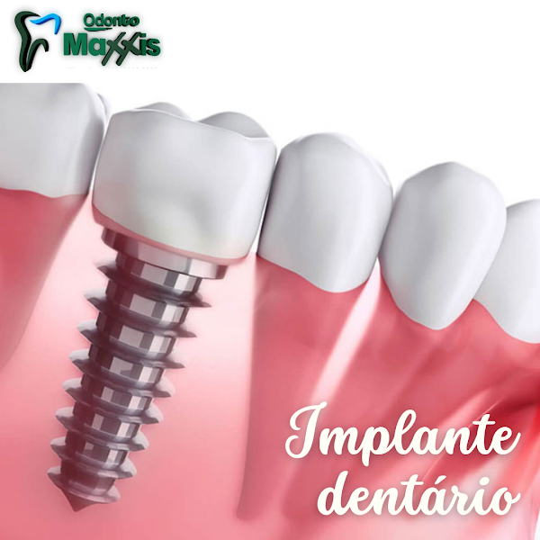 Foto 3 de Clínica Odonto Maxxis - Dentista em Indaiatuba